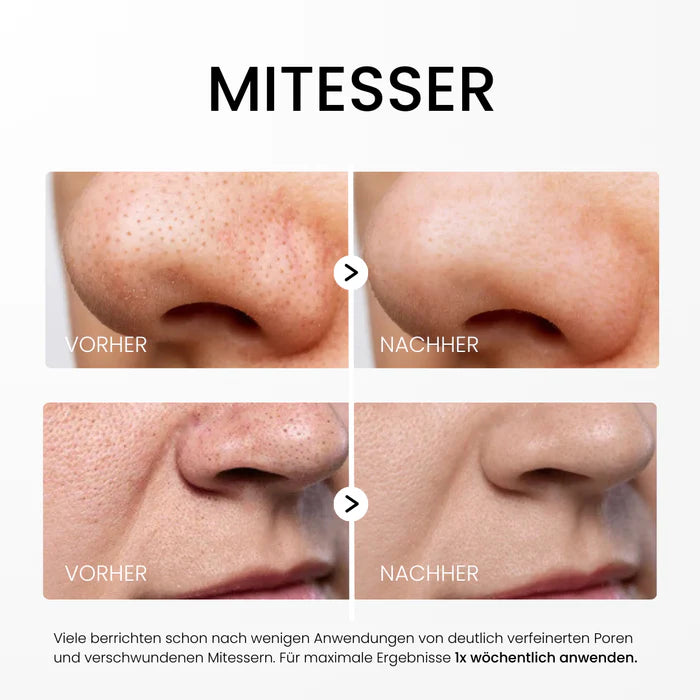 Rice Peel Serum – Für reine Haut & natürlichen Glow
