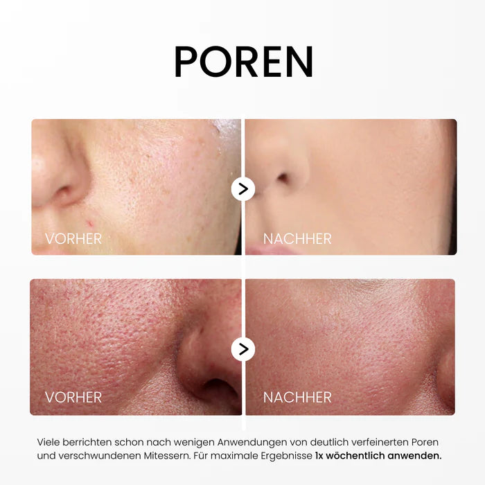Rice Peel Serum – Für reine Haut & natürlichen Glow