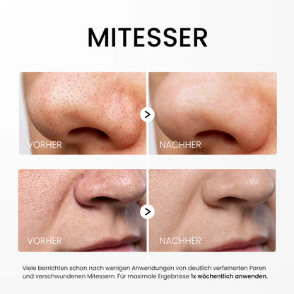 Rice Peel Serum – Für reine Haut & natürlichen Glow